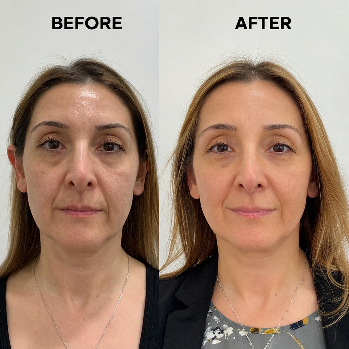 TruTone Calcium Eye Cream